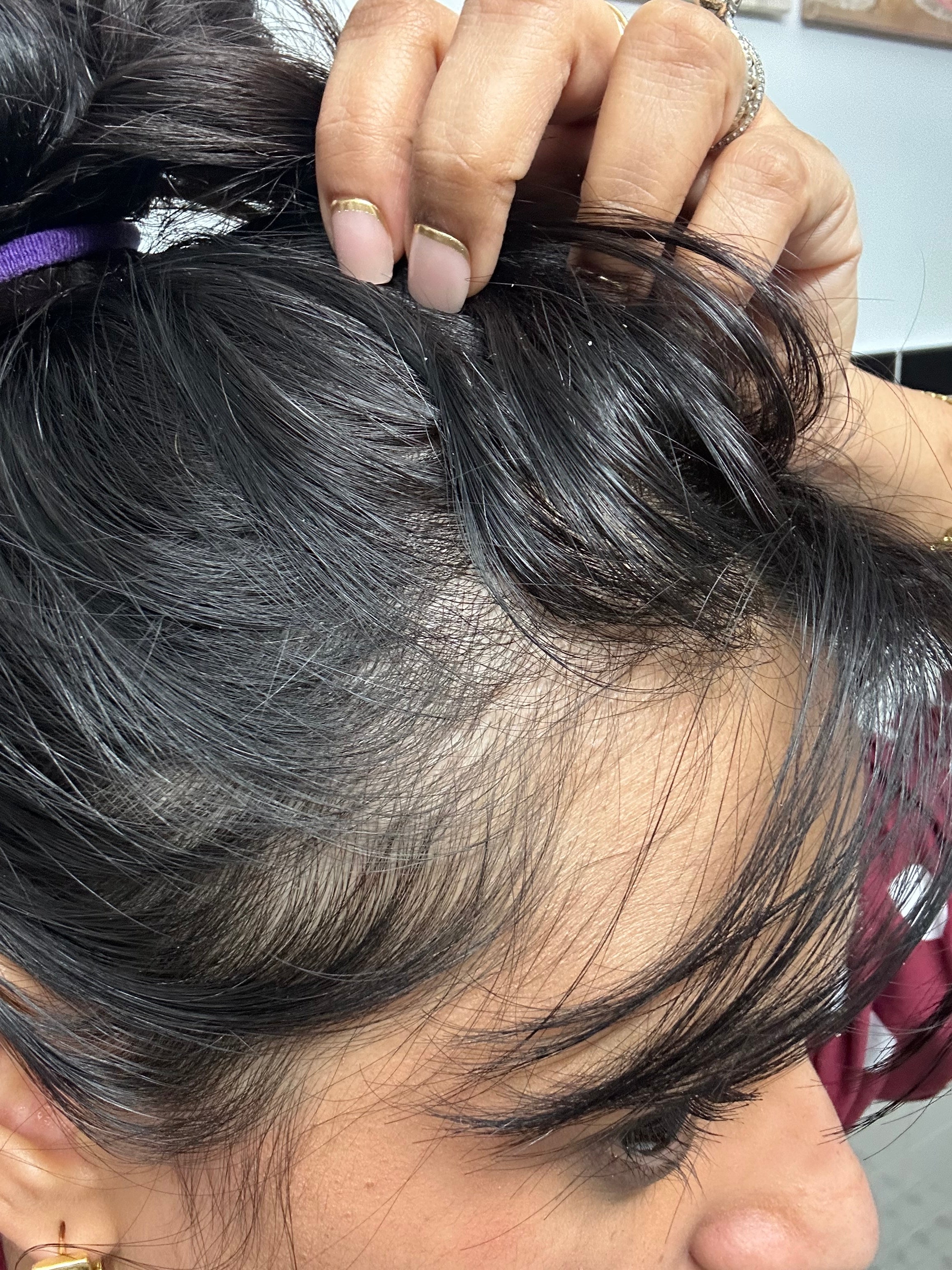 Keśa Scalp Repair Oil | Pre-Wash Scalp Treatment for a Healthy and Clean Scalp | Tea tree, Amla, Lavender, Jojoba, Black Seed