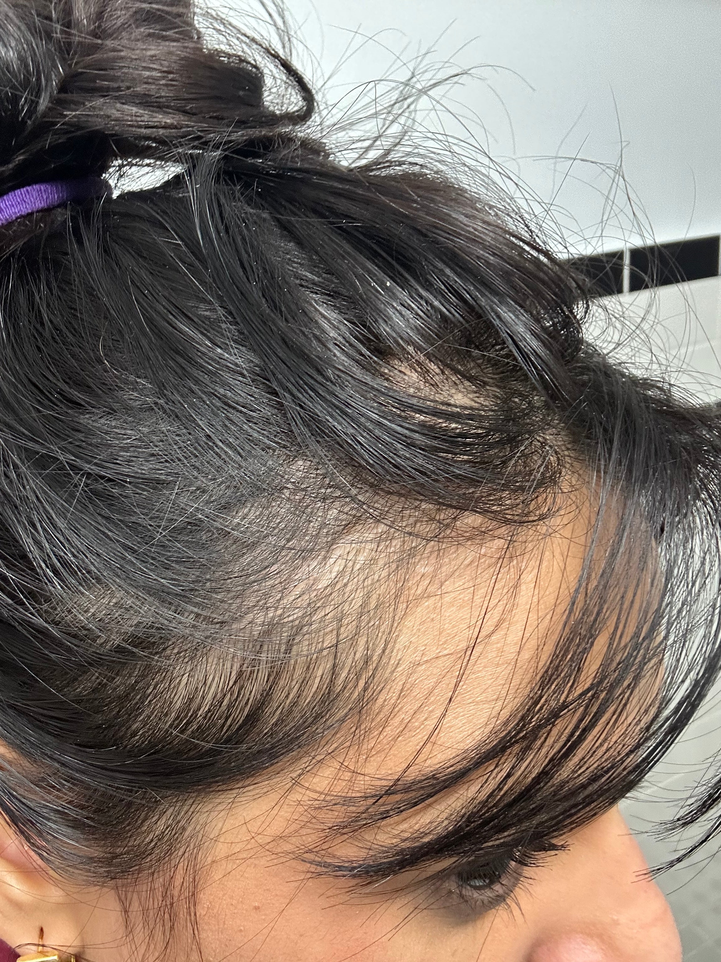 Keśa Scalp Repair Oil | Pre-Wash Scalp Treatment for a Healthy and Clean Scalp | Tea tree, Amla, Lavender, Jojoba, Black Seed