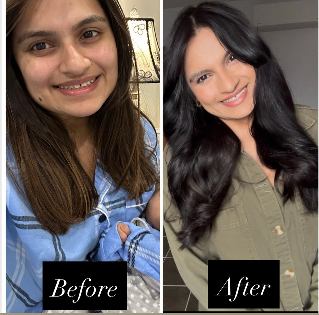 Keśa Hair Growth Oil for PCOS-Related Hair Loss