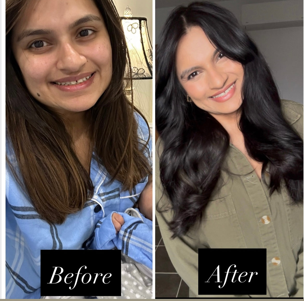 Keśa Hair Growth Oil for PCOS-Related Hair Loss