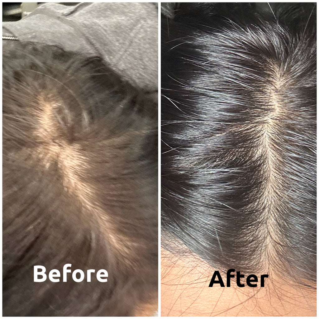 Keśa Hair Growth Oil | Natural Organic Serum for Alopecia Hair Loss with DHT Blockers