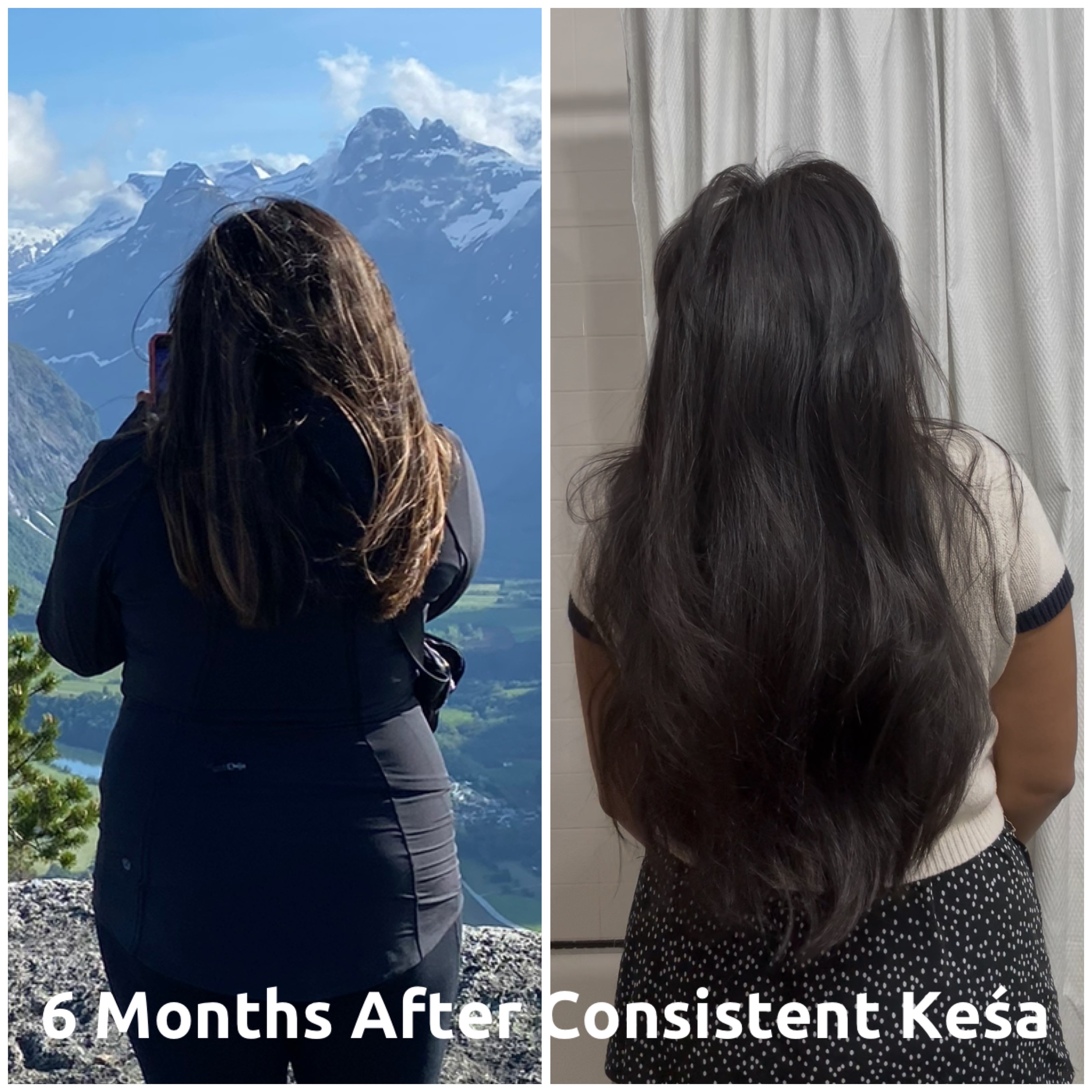 Keśa Hair Growth Oil for PCOS-Related Hair Loss