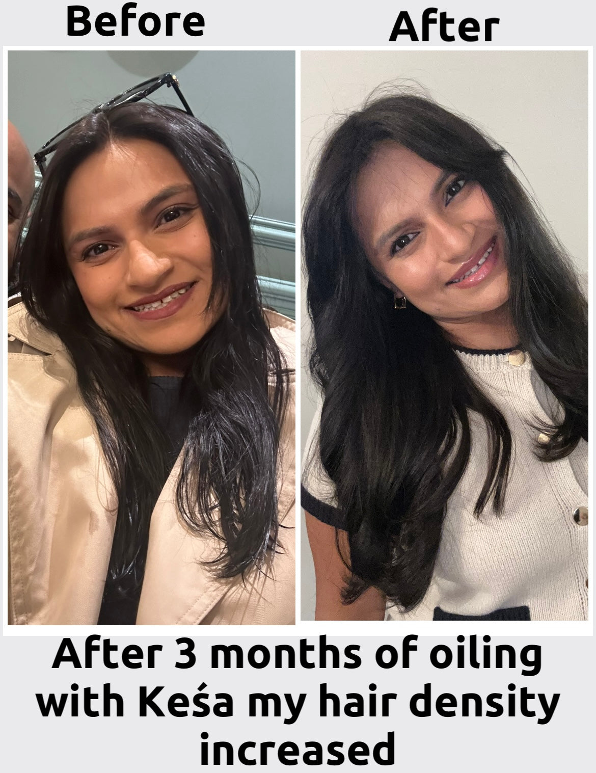 Keśa Hair Growth Oil for PCOS-Related Hair Loss